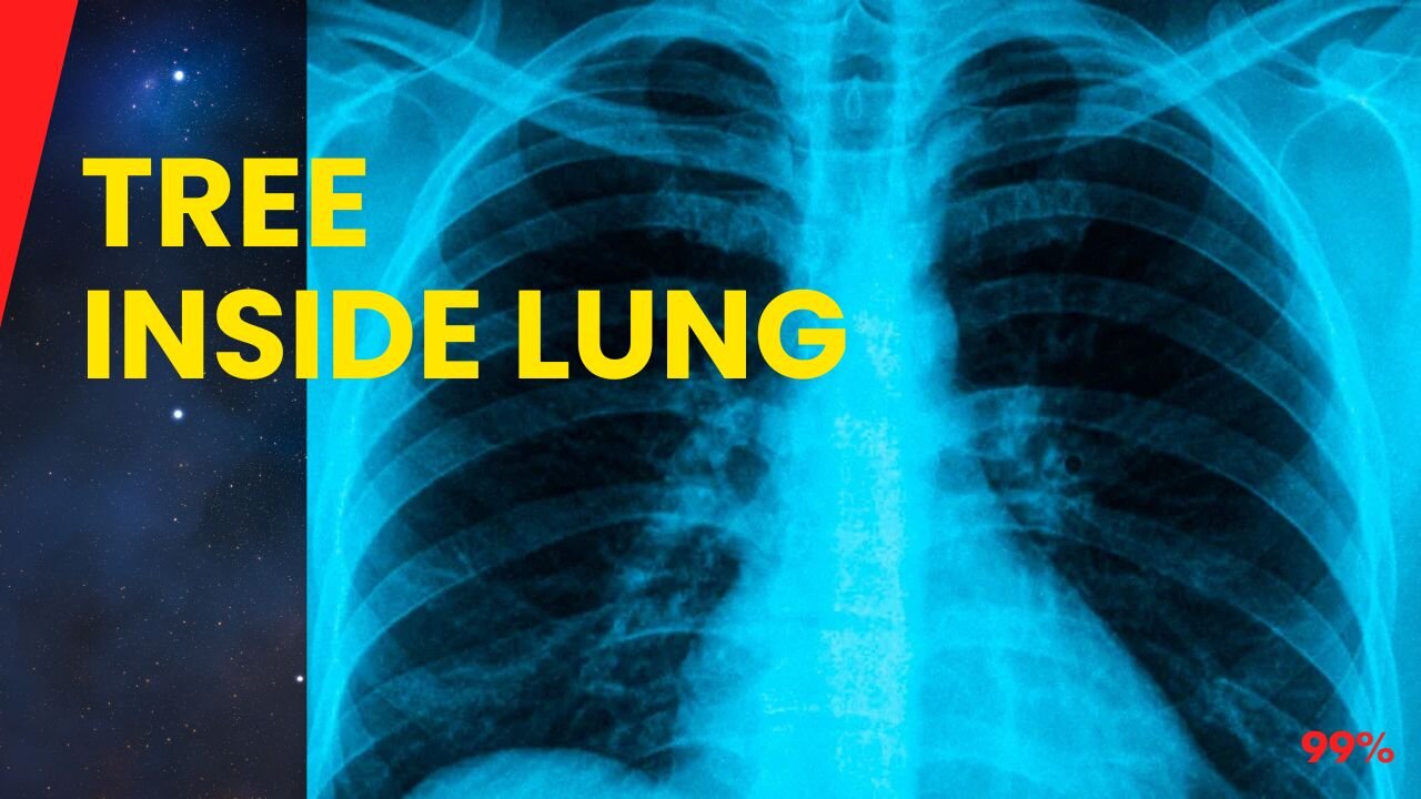 Lung Tree Shock: The Unbelievable Medical Discovery!