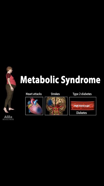 METABOLIC SYNDROME & THE FOOD SUPPLY, OUR FARMING SYSTEM HAS EVOLVED TOWARDS EFFICIENCY.🕎Ezekiel 4;10-16 “the children of Israel eat their defiled bread among the Gentiles”