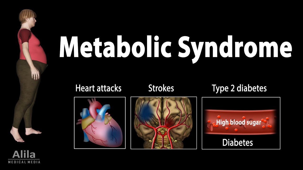 METABOLIC SYNDROME & THE FOOD SUPPLY, OUR FARMING SYSTEM HAS EVOLVED TOWARDS EFFICIENCY.🕎Ezekiel 4;10-16 “the children of Israel eat their defiled bread among the Gentiles”