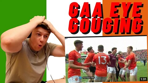 GAA EYE GOUGING - RTE REACTION!! ((INSANE REACTION!!))