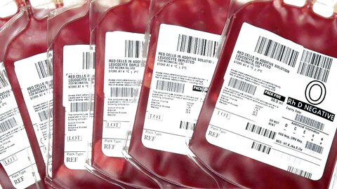 WHERE DO YOUR BLOOD DONATIONS REALLY GO? - ONLY 20% IS USED FOR TRANSFUSIONS - THE REST...