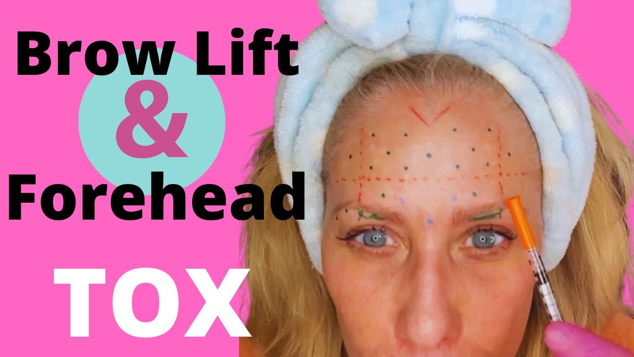 How to Tox Forehead, 11’s and Add a Brow Lift