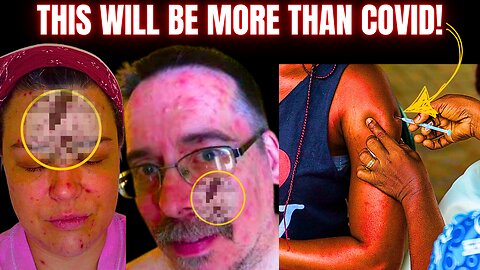 Millions Will Perish - God Showed Me A Coming Pandemic!