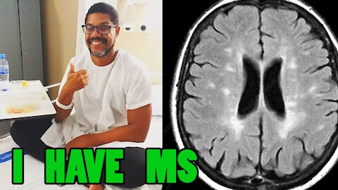 I HAVE MS