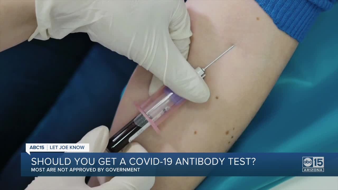 Should you get the COVID-19 antibody test?