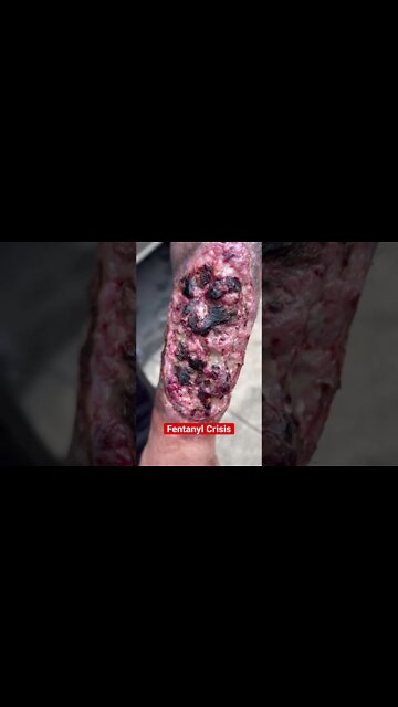 ⚠️⚠️⚠️ Don't Wait; Get Help Now!