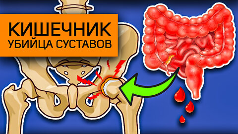 Болят суставы и кишечник ?