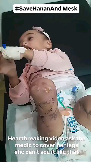 Heartbreaking video ask the medic to cover her legs she can't see it like that #gaza #palestine
