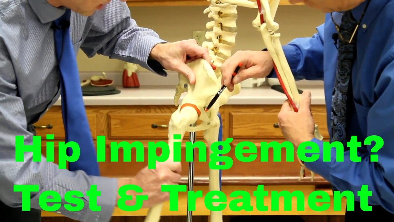 Hip Impingement? Causes, Treatment, & Test for Femoral Acetabular Syndrome