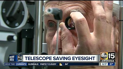 Man's sight back after telescope implant