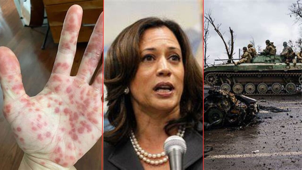 MonkeyPox Global Shutdown, Kamala Harris, World War 3