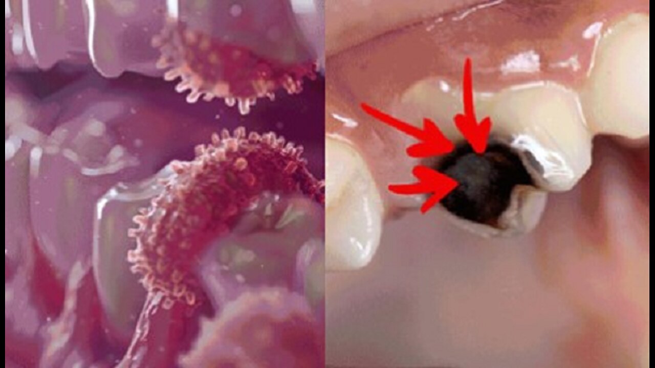 Odd 'oral flush' banishes gum disease & tooth decay