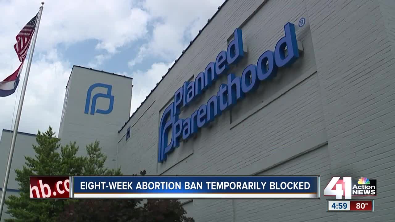 Judge temporarily blocks Missouri's 8-week abortion ban