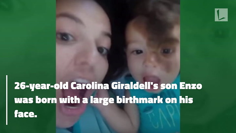 Age 1 Son Grins Ear-to-Ear When He Sees Birthmark Mother Painted on Her Face to Match His