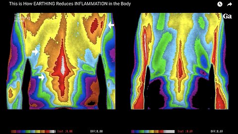 This is How EARTHING Reduces INFLAMMATION in the Body