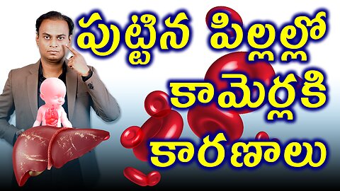 పుట్టిన పిల్లల్లో కామెర్లు కారణాలు | Triggering Factors, Causes for Newborn Jaundice Treatment Cure