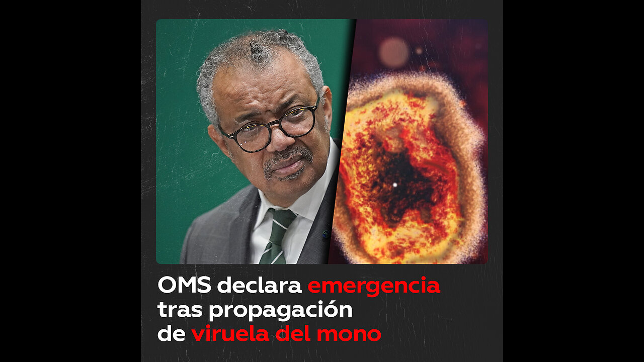 La OMS declara emergencia sanitaria global por brote de la viruela del mono