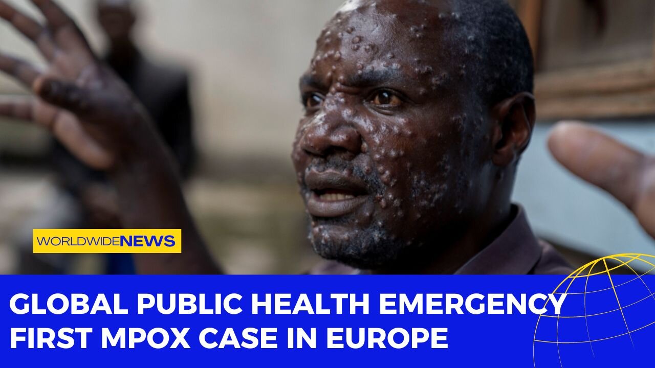 Global Public Health Emergency: First Mpox Case in Europe