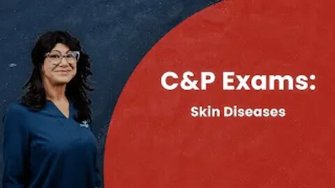 C&P Exams - Skin Diseases