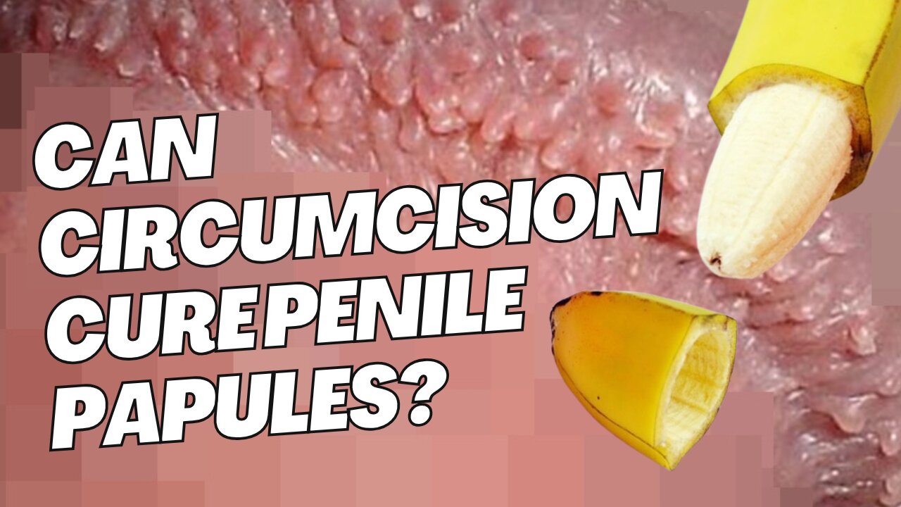 Explained: The Relationship Between Circumcision and Penile Papules