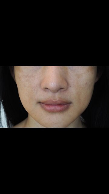 Dark Spot Eraser: 3-Day Radiance Challenge ✨🌈✨