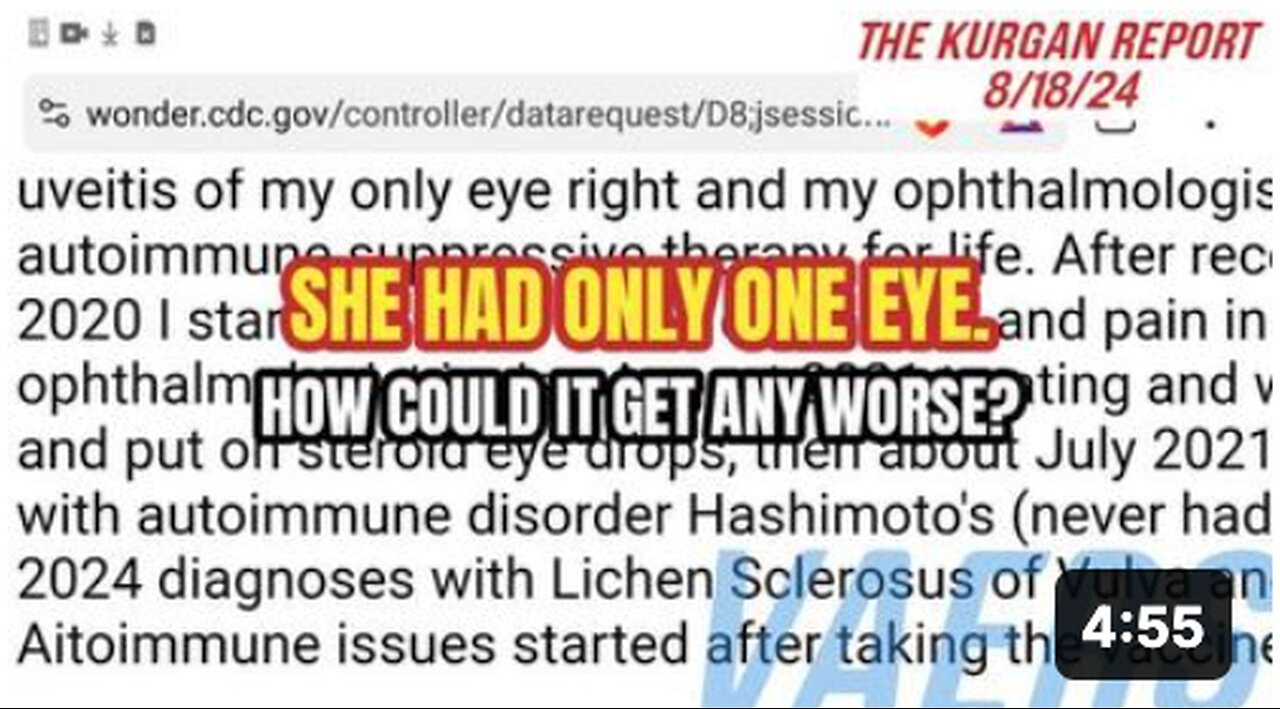 VAERS: 38 YEAR OLD LADY WITH ONE EYE DESTROYS THE OTHER EYE! (AND HER VULVA?) 🤯😫