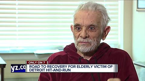 Detroit hit and run victim speaks out as search continues for a suspect