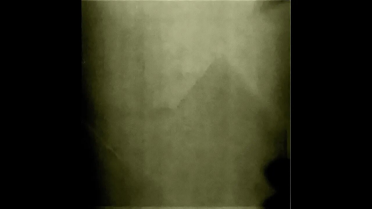 Pyramids on the Moon Surface? Some People Seem To Think So