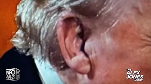 Learn🤔What Really👀Happened To👉Trump's Ear👂During👀Assassination🔫Attack💥🔥😎