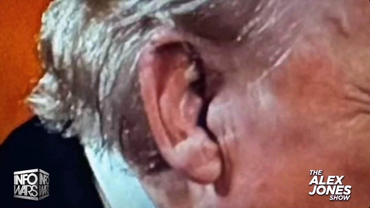Learn🤔What Really👀Happened To👉Trump's Ear👂During👀Assassination🔫Attack💥🔥😎