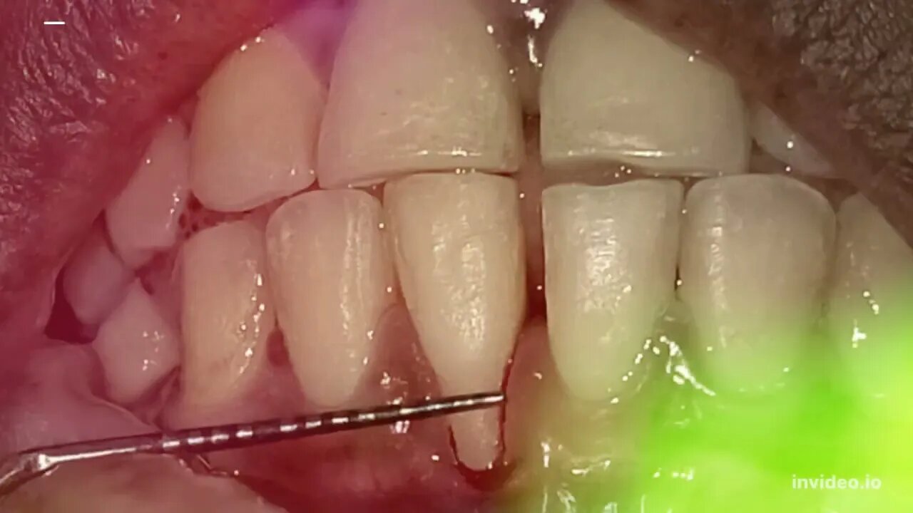 Graft Price Prediction 2022, 2025, 2030 GRFT Price Forecast Cryptocurrency Price Prediction