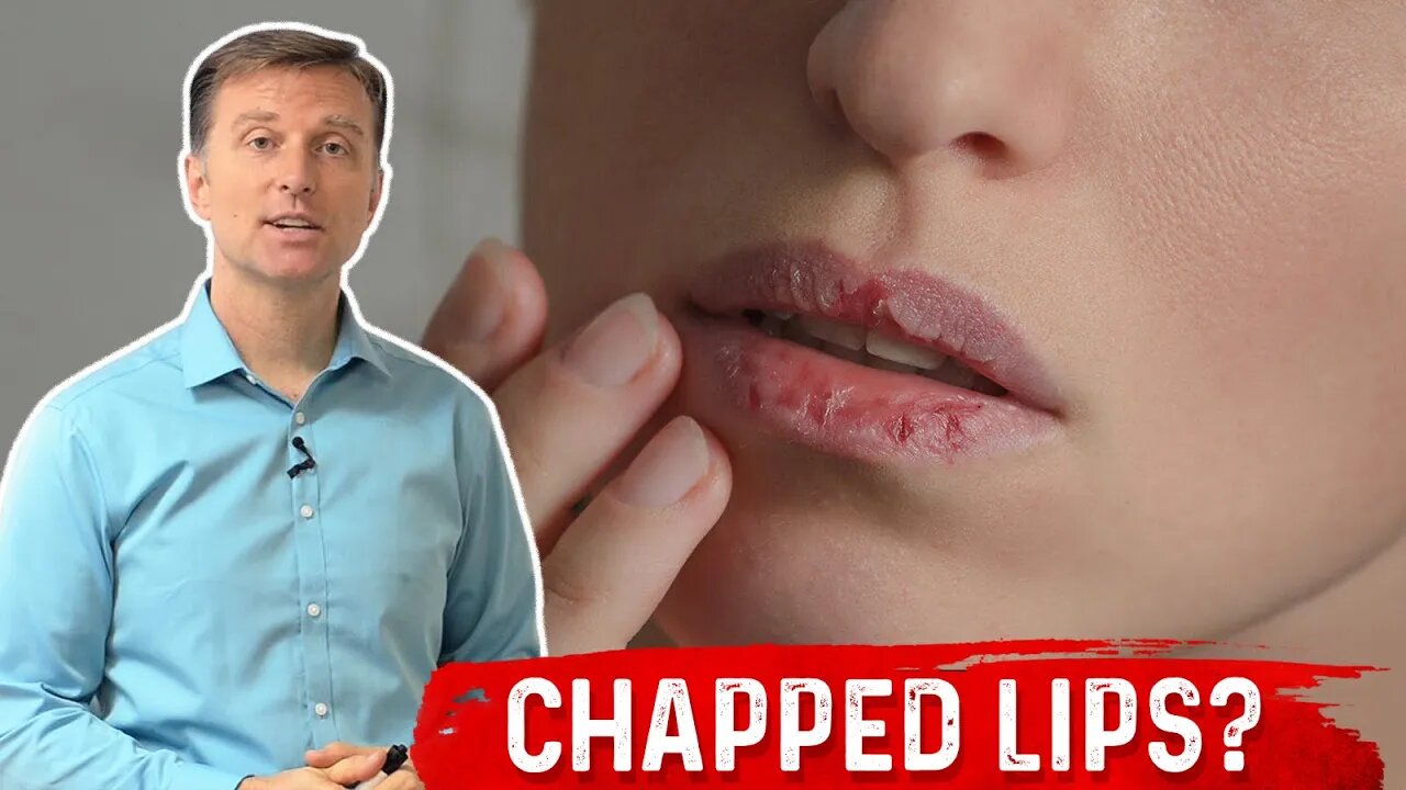 Which Vitamin Deficiency Causes Chapped / Cracked Lips? – Dr. Berg