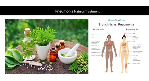 Pneumonia Natural Treatment Options