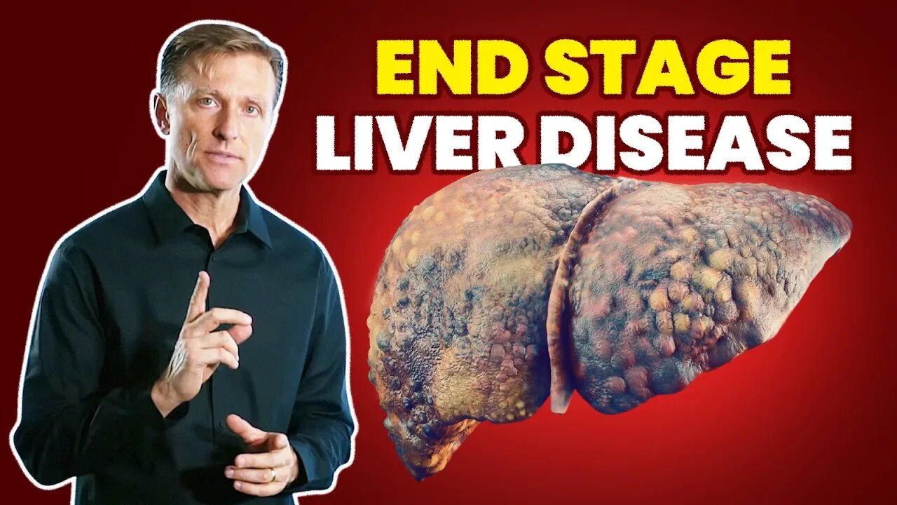 10 Signs of a Dying Liver (End Stage Liver Disease)