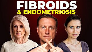 80% of Women Develop Fibroids—Here's Why!