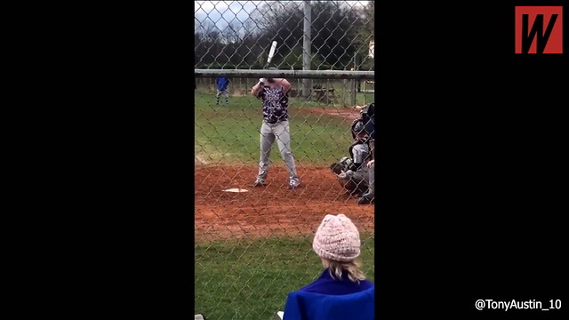 Watch: 1-Armed Kid Goes Viral With Incredible Feat On Baseball Field