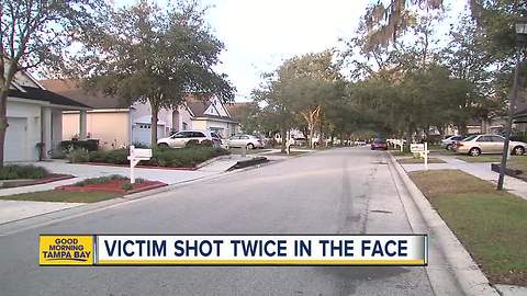 Man shot twice in the face during violent home invasion in Lutz