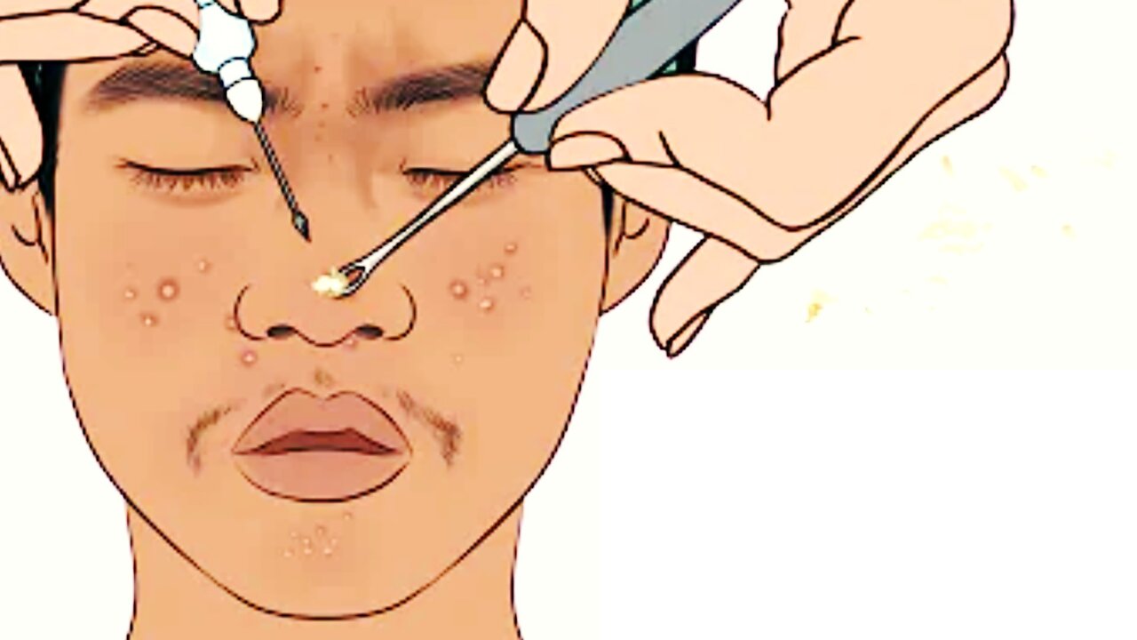 ASMR Pimple removal animation