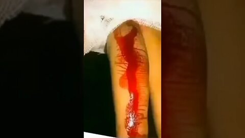 accident#shortsvideoviral #viralshorts