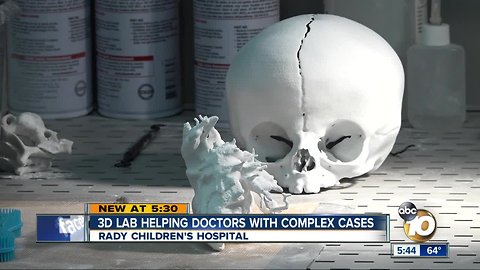Tiny patients get help from 3D technology
