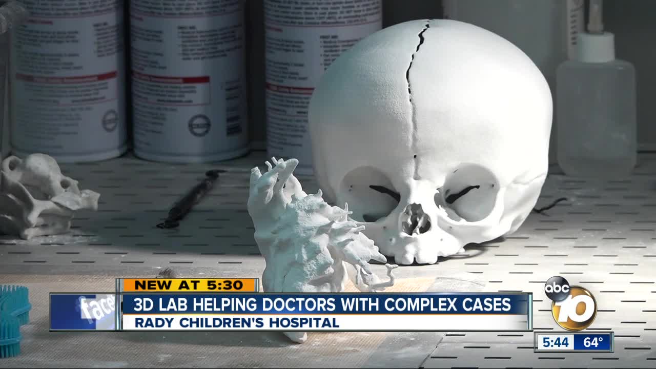 Tiny patients get help from 3D technology