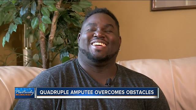 Milwaukee quadruple amputee refuses to let setbacks define his life