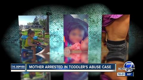 Mother of severely-injured Lakewood toddler arrested for possible child abuse