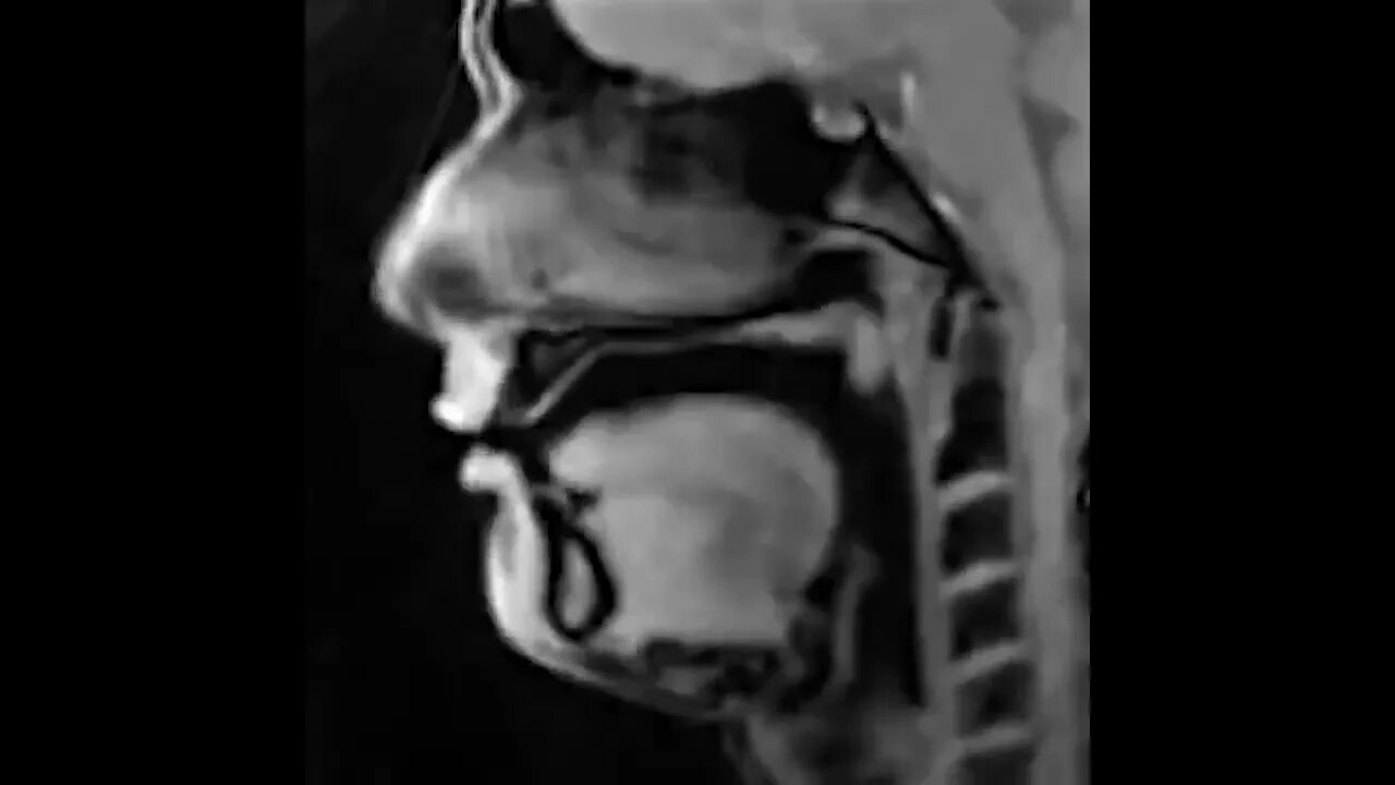 Real-time MRI scan of a person talking.