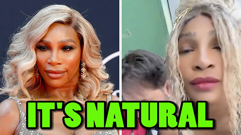 Serena Williams Is Bleaching Her Skin