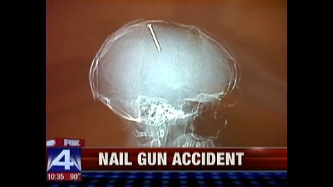 Por que sou um homem medíocre e não um super-homem?