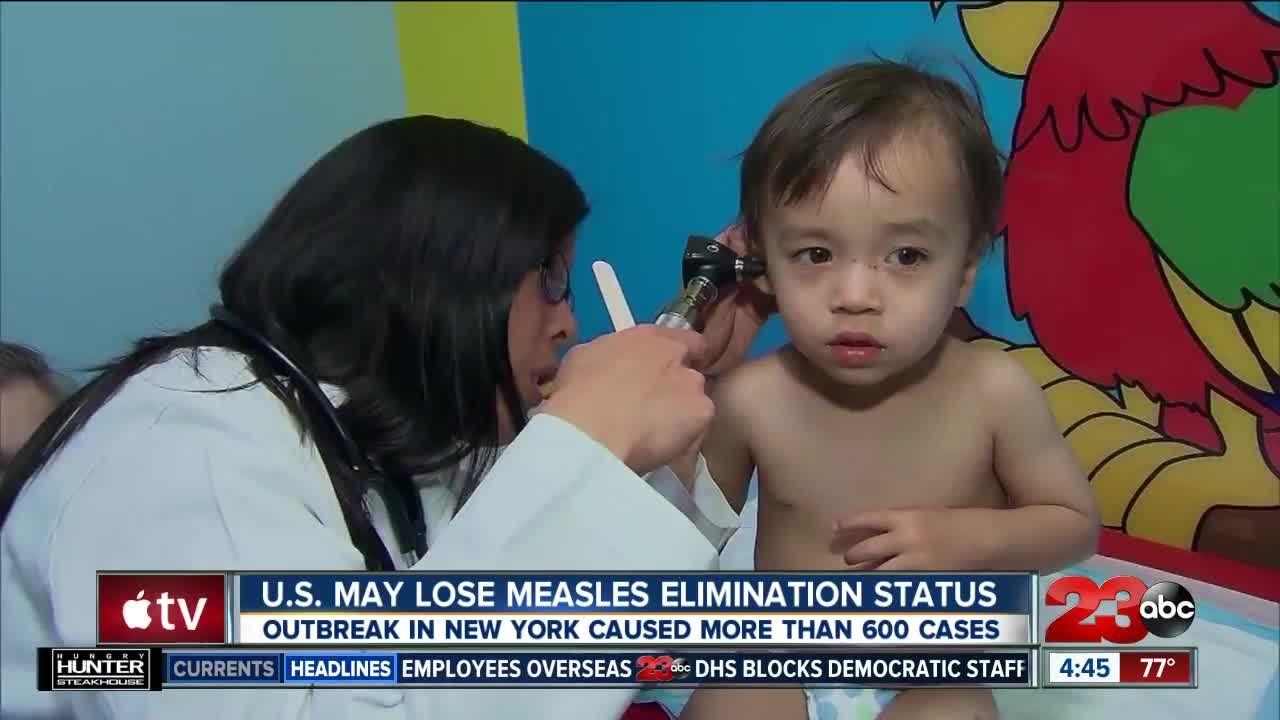 United States may lose measles elimination status due to outbreaks