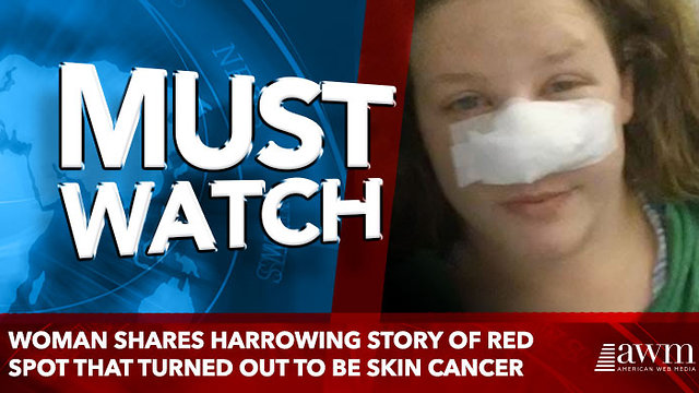 Woman shares harrowing story of red spot that turned out to be skin cancer