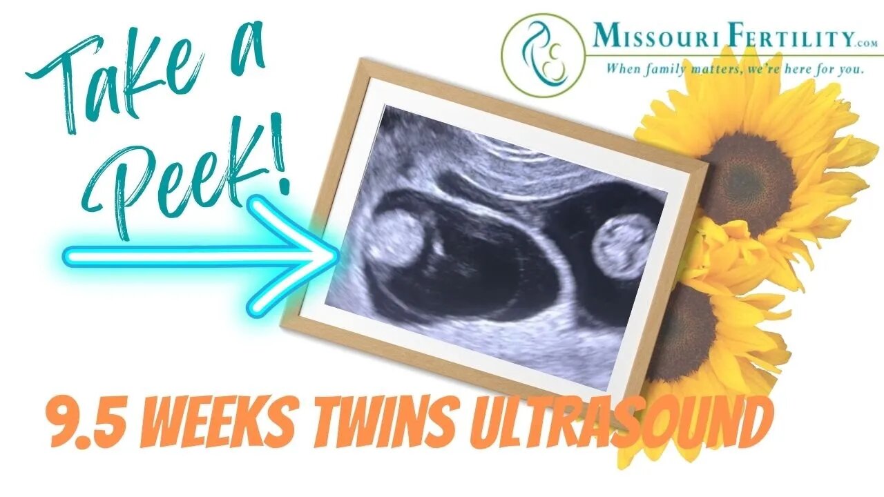 Ultrasound of Twin Pregnancy at 9 1/2 weeks