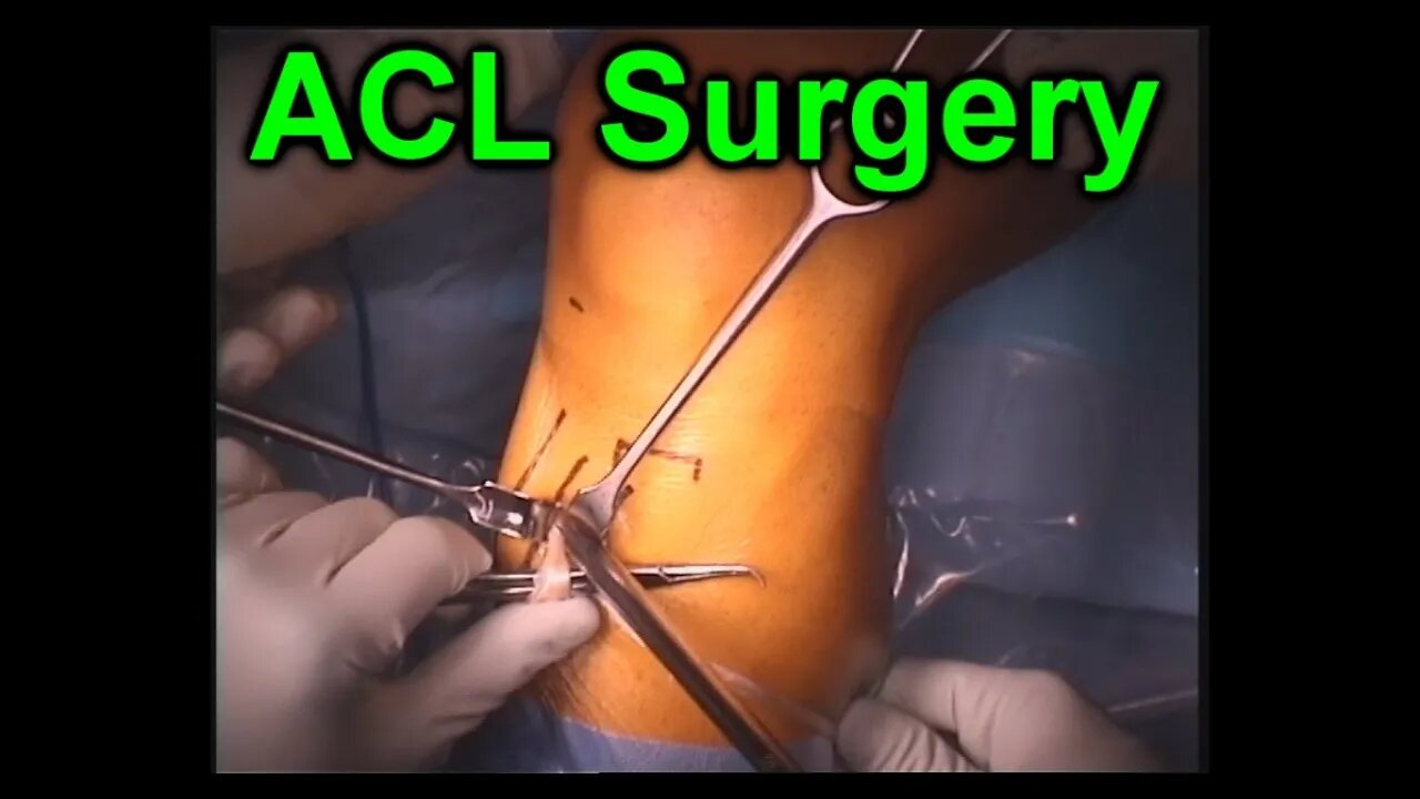 ACL Knee Orthopaedic Reconstruction Surgery